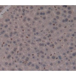 Metal Regulatory Transcription Factor 1 (MTF1) Antibody