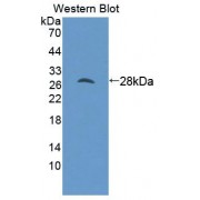 Western blot analysis of recombinant Human MTF1 Protein.