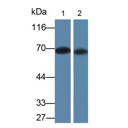 Advanced Glycation End Product (AGE) Antibody