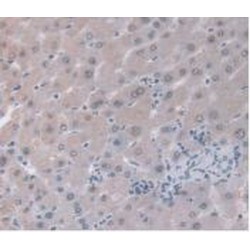 Alpha-1-Acid Glycoprotein 1 (ORM1) Antibody