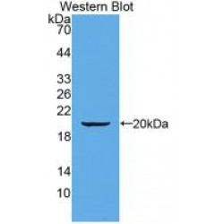 Alpha-1-Acid Glycoprotein 1 (ORM1) Antibody