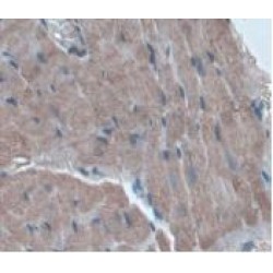 Alpha-1-Acid Glycoprotein 1 (ORM1) Antibody