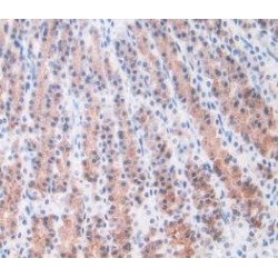 Alpha-1-Acid Glycoprotein 1 (ORM1) Antibody