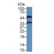 Western blot analysis of Rat Bladder lysate, using Rat a1AGP Antibody (2 µg/ml) and HRP-conjugated Goat Anti-Mouse antibody (<a href="https://www.abbexa.com/index.php?route=product/search&amp;search=abx400001" target="_blank">abx400001</a>, 0.2 µg/ml).