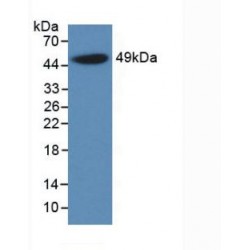Alpha-1-Acid Glycoprotein 1 (ORM1) Antibody