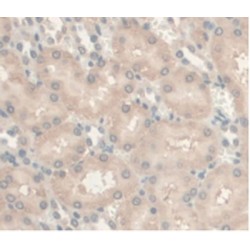 Androgen Receptor (AR) Antibody