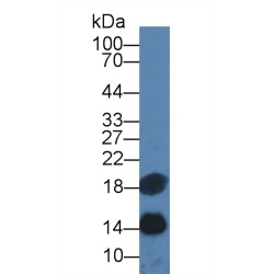 Renin (REN) Antibody