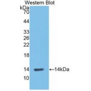Western blot analysis of recombinant Rat REN.