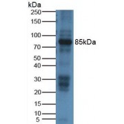 Western blot analysis of Rat Placenta Tissue, using Rabbit Anti-Rat DAO Antibody (2 µg/ml) and HRP-conjugated Rabbit Anti-Mouse antibody (<a href="https://www.abbexa.com/index.php?route=product/search&amp;search=abx400002" target="_blank">abx400002</a>, 1:5000 dilution).