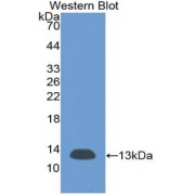 Western blot analysis of recombinant Rat b2M.