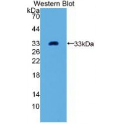 Growth Differentiation Factor 11 (GDF11) Antibody