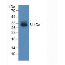 Insulin Like Growth Factor Binding Protein 4 (IGFBP4) Antibody