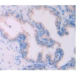 Interleukin 4 (IL4) Antibody