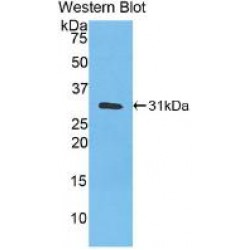 Carbonic Anhydrase III, Muscle Specific (CA3) Antibody