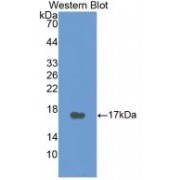 Western blot analysis of recombinant Human CT.