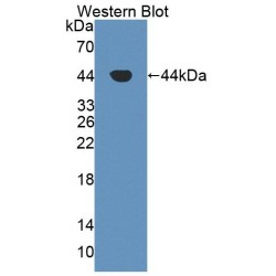 Aspartate Aminotransferase, Cytoplasmic / AST (GOT1) Antibody