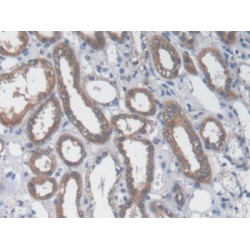 Aspartate Aminotransferase, Cytoplasmic / AST (GOT1) Antibody