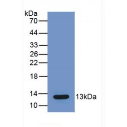 C-C Motif Chemokine 2 / MCP1 (CCL2) Antibody