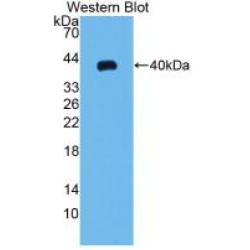 C-C Motif Chemokine 20 / MIP3A (CCL20) Antibody