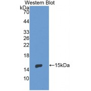 Western blot analysis of recombinant Human ENG.