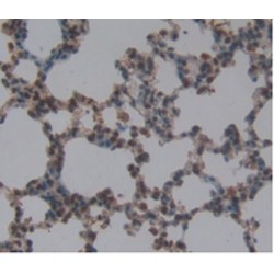 Mast/Stem Cell Growth Factor Receptor Kit (KIT) Antibody