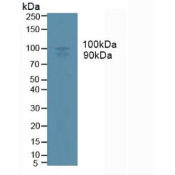 A Disintegrin And Metalloprotease 17 (ADAM17) Antibody