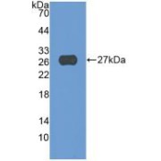 Western blot analysis of recombinant Human ADAM17.