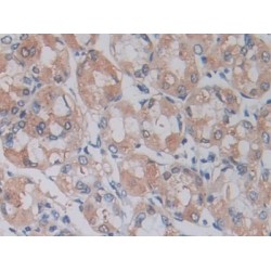 A Disintegrin And Metalloprotease 17 (ADAM17) Antibody