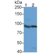 Western blot analysis of (1) MCF7, and (2) HCT116 cell lysates, using Mouse Anti-Human INSR Antibody (0.8 µg/ml) and HRP-conjugated Goat Anti-Mouse antibody (<a href="https://www.abbexa.com/index.php?route=product/search&amp;search=abx400001" target="_blank">abx400001</a>, 0.2 µg/ml).