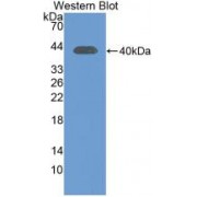 Western blot analysis of recombinant Human INSR.