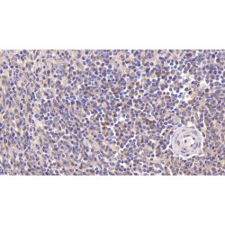 Insulin Receptor (INSR) Antibody