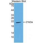 Western blot analysis of recombinant Human gGT1.