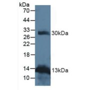 abx131777