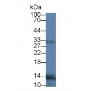 Western blot analysis of Human Leukocyte lysate, using Human TNFSF11 Antibody (3 µg/ml) and HRP-conjugated Goat Anti-Mouse antibody (<a href="https://www.abbexa.com/index.php?route=product/search&amp;search=abx400001" target="_blank">abx400001</a>, 0.2 µg/ml).