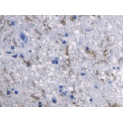 Tumor Necrosis Factor Ligand Superfamily Member 11 (TNFSF11) Antibody
