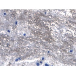 Tumor Necrosis Factor Ligand Superfamily Member 11 (TNFSF11) Antibody