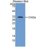 Western blot analysis of recombinant Human TLR1.