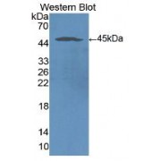 Western blot analysis of recombinant Human ICAM1.