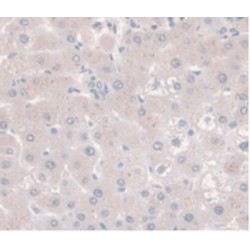 5'-Nucleotidase / CD73 (NT5E) Antibody