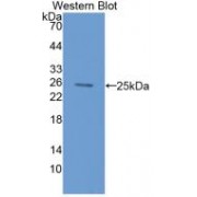 Western blot analysis of recombinant Rat uPAR.