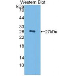 Complement Factor H (CFH) Antibody