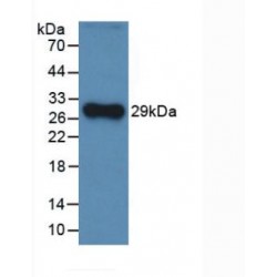 Complement Factor H (CFH) Antibody