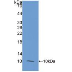 S100 Calcium Binding Protein A12 (S100A12) Antibody