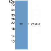 Western blot analysis of recombinant Human KRT9.