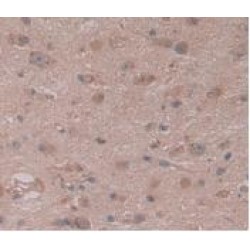 Collagen Type I Alpha 1 (COL1A1) Antibody