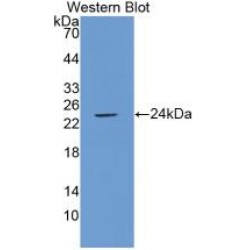 Phospholipase A2, Cytosolic (cPLA2) Antibody
