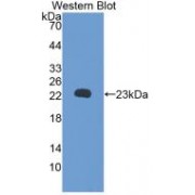 Western blot analysis of recombinant Rat RBP5.
