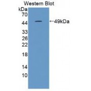 Western blot analysis of recombinant Horse IL10.