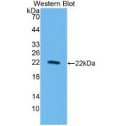 Western blot analysis of recombinant Rat IL10.