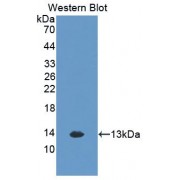 Western blot analysis of recombinant Rat CXCL1 Protein.